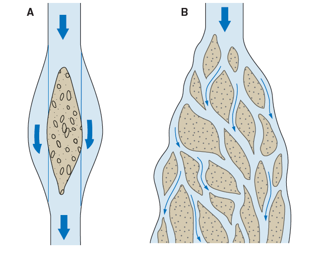 braided stream diagram